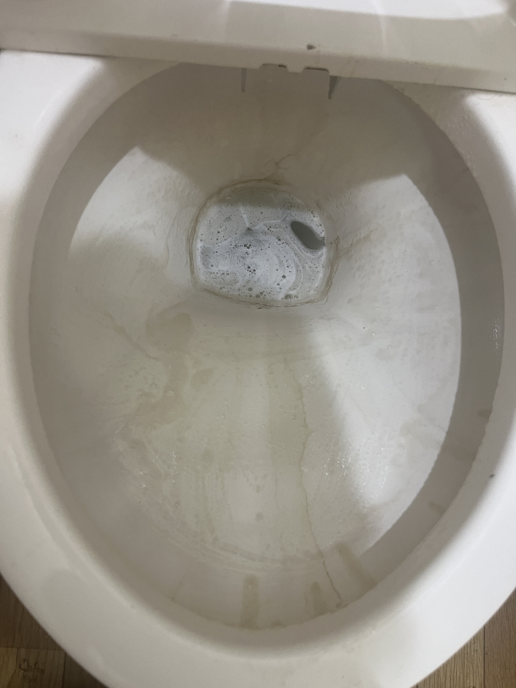 東京都足立区舎人のトイレクリーニングの作業前1